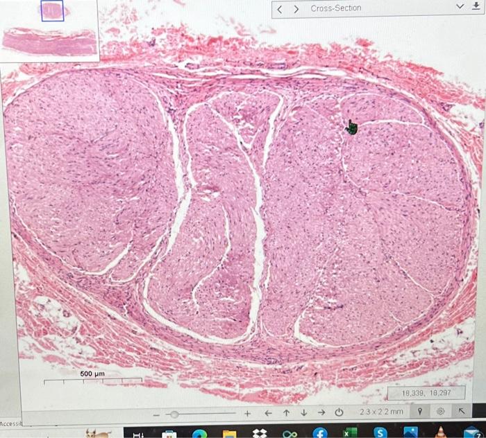 nerve cross section slide