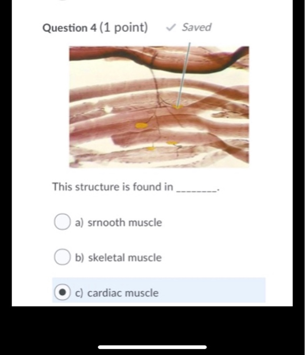 Solved Question 4 (1 Point) Saved This Structure Is Found In | Chegg.com