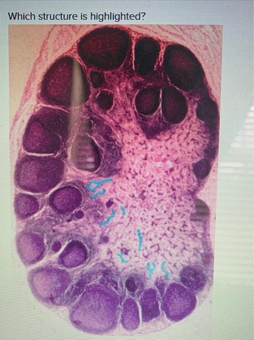 Solved Which Structure Is Highlighted Trabecula Of Lymph Chegg