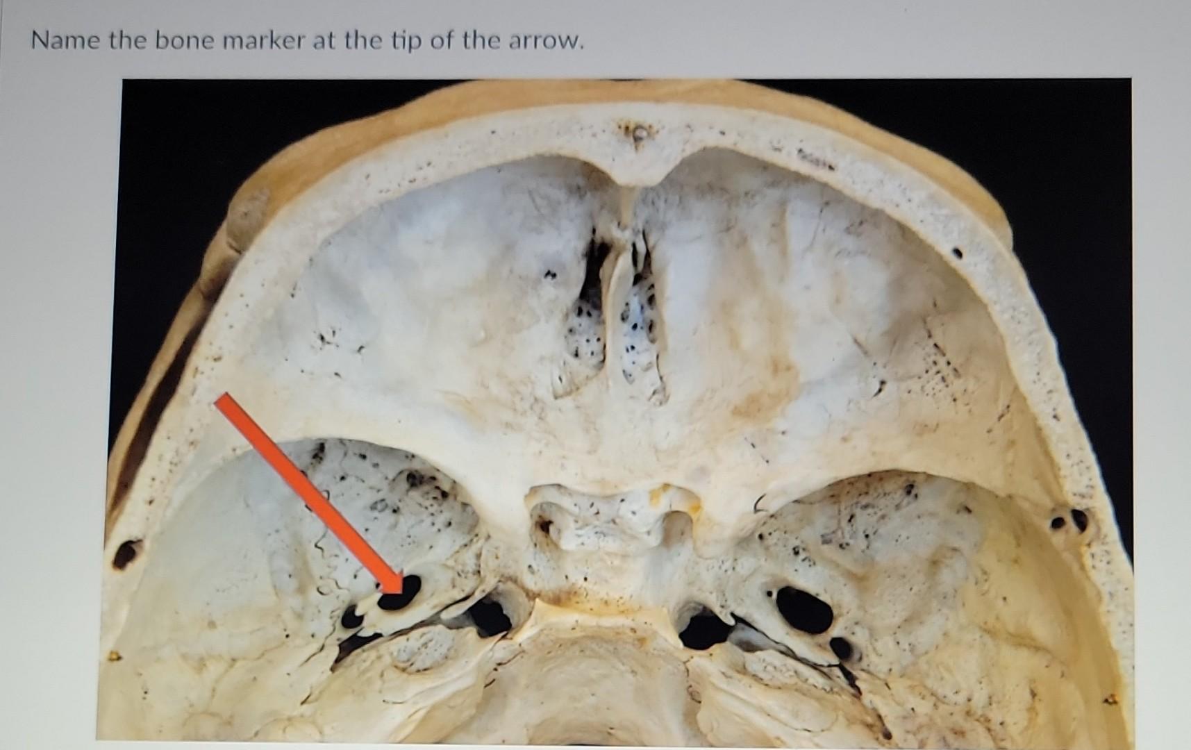 Tip Bone Solved Name the bone marker at the tip of the arrow. Name | Chegg.com