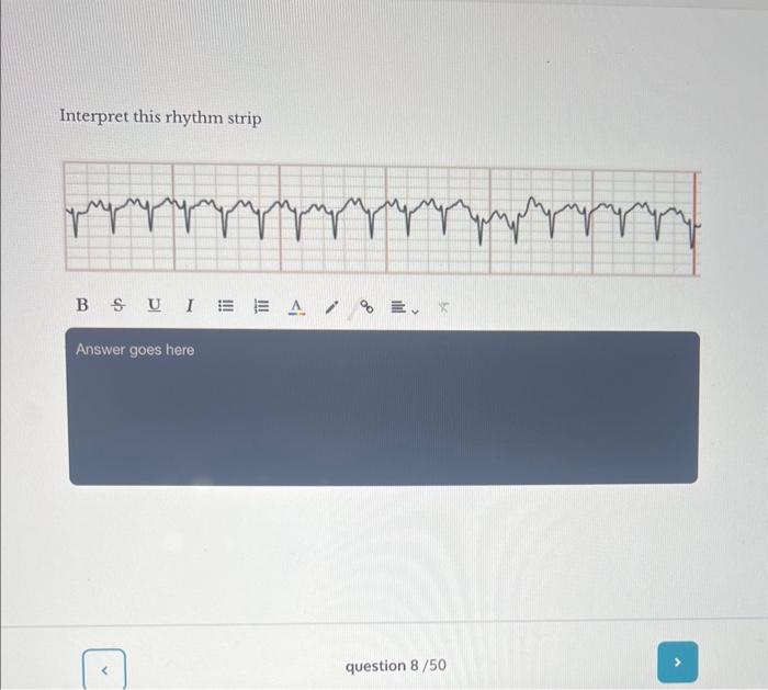 Solved Interpret This Rhythm Strip Interpret This Rhythm | Chegg.com