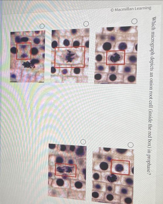 Which micrograph depicts an onion root cell (inside | Chegg.com