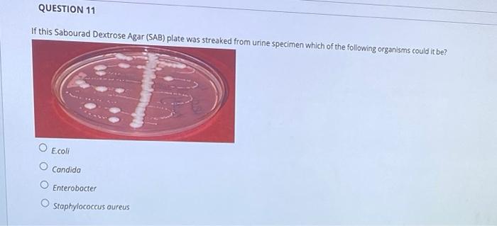 Solved QUESTION 11 If this Sabourad Dextrose Agar (SAB) | Chegg.com