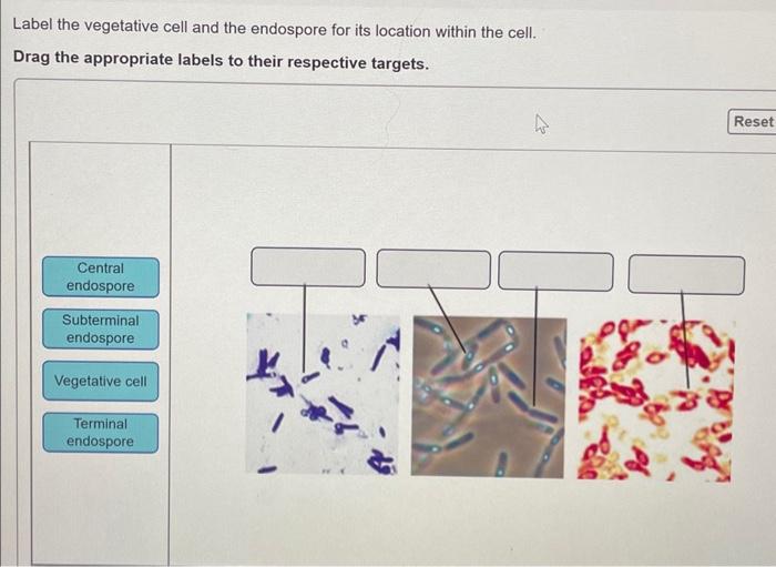 Solved Label the vegetative cell and the endospore for its