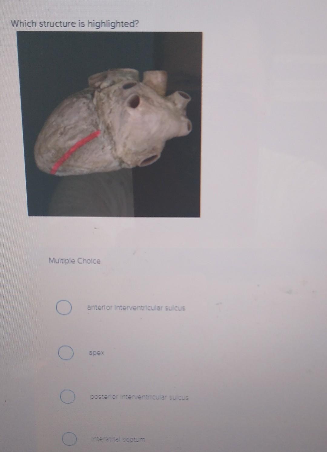 Which structure is highlighted? Multiple Cholce anterlor interventricular sulcus apex postenorinterenticu9: aniza nteratis se