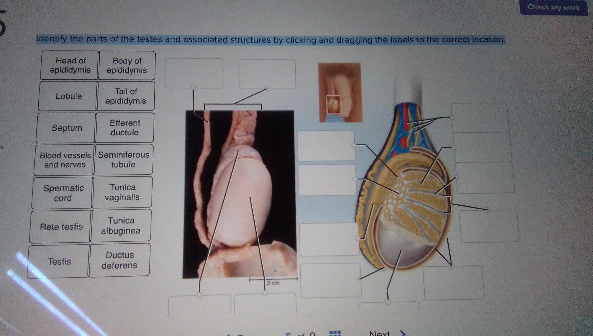 Solved Check my werk Identify the parts of the testes and | Chegg.com