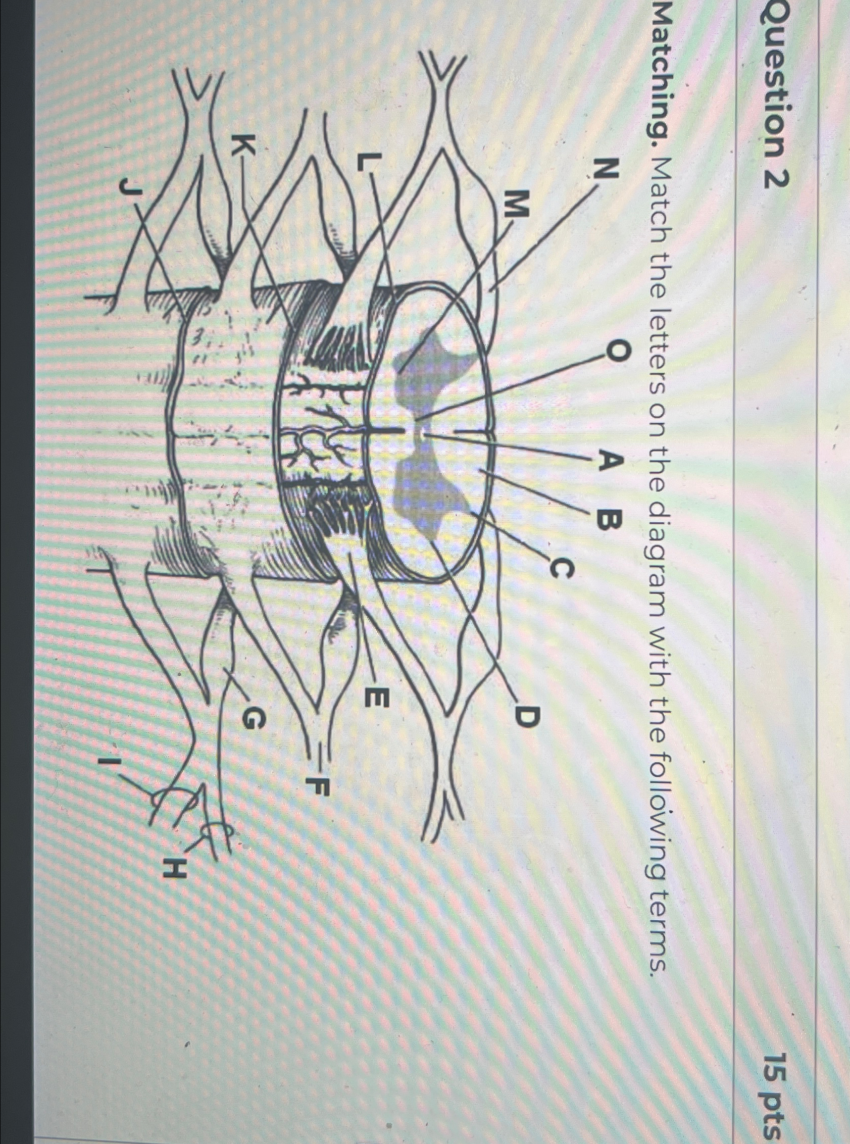 Solved Question 215 ﻿ptsMatching. Match the letters on the | Chegg.com