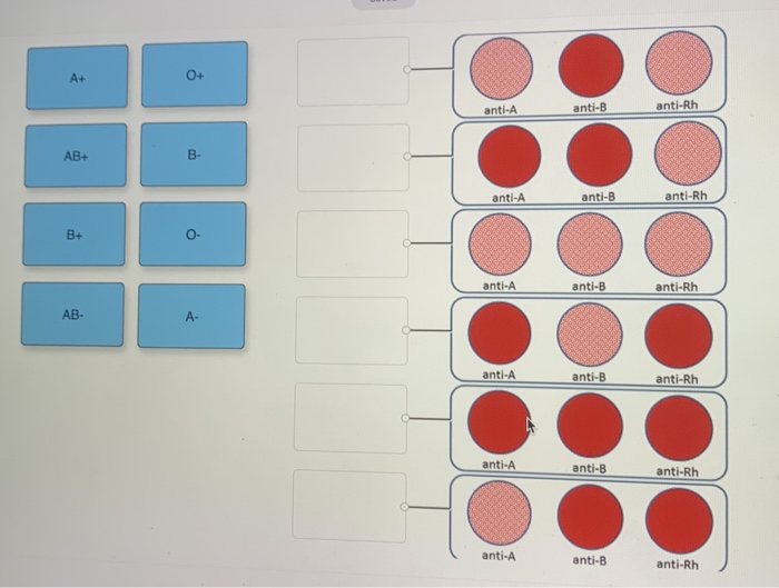Solved A+ 0+ Anti-A Anti-B Anti-Rh AB+ B- Anti-A Anti-B | Chegg.com