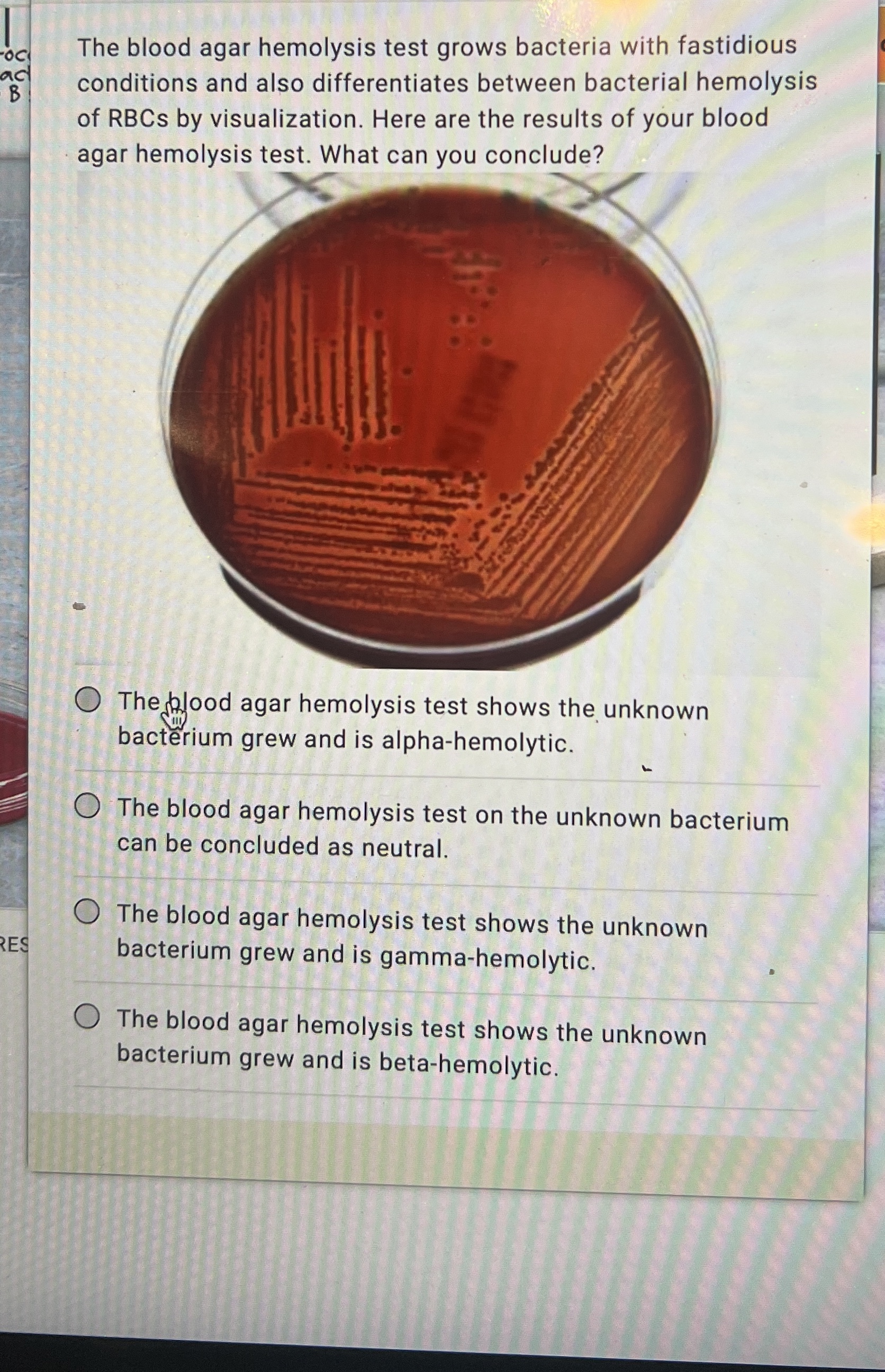 Solved The blood agar hemolysis test grows bacteria with | Chegg.com