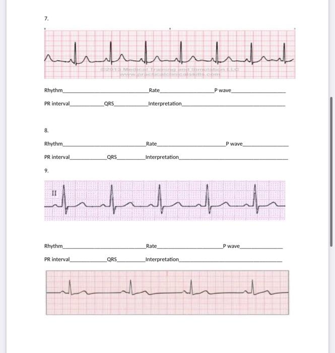 2. Rhythm Rate P wave PR interval QRS Interpretation. | Chegg.com