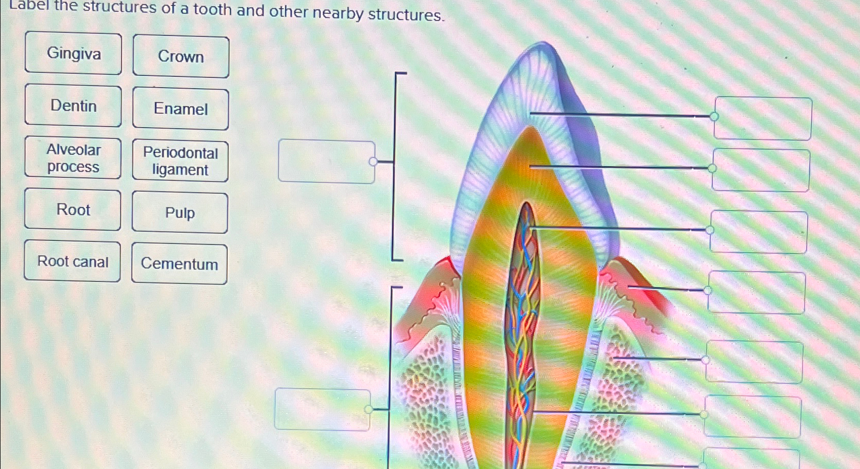 Solved Label the structures of a tooth and other nearby | Chegg.com