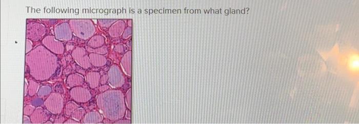 Solved The following micrograph is a specimen from what | Chegg.com