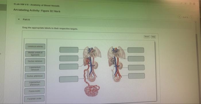 CLab HW #s-Anatomy of Blood Vessels
Art-labeling Activity: Figure 32.14a-b
Part A
Drag the appropriate labels to their respec