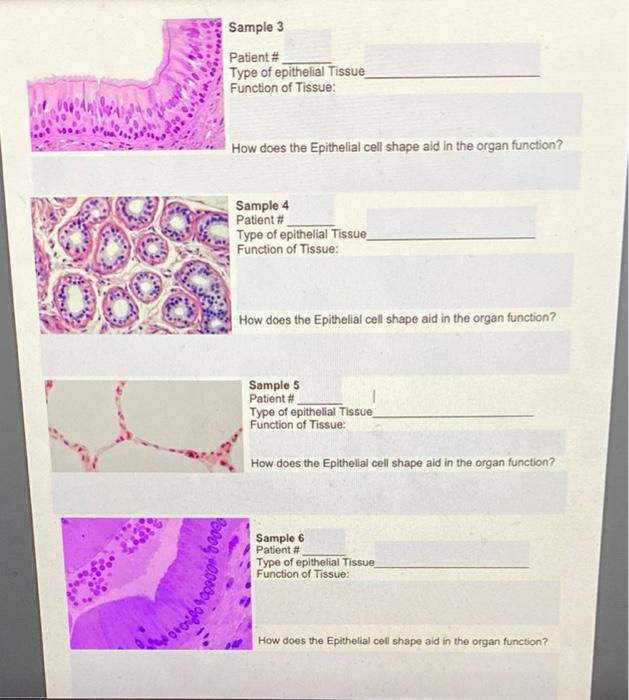 epithelial-tissue-biopsies-working-in-the-histology-chegg-com