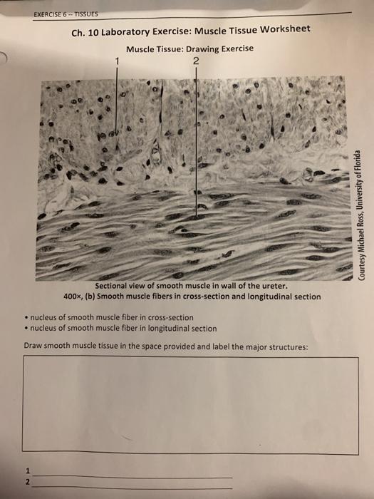 Solved EXERCISE 6 - TISSUES Ch. 10 Laboratory Exercise