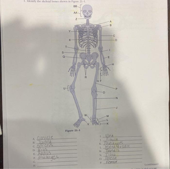 Identify the skeletal bones shown in Figure 21-1. BB AA N A B с Х D T S Q E H - R GF P -N M L K K Figure 21-1 Fibula A. Glavi