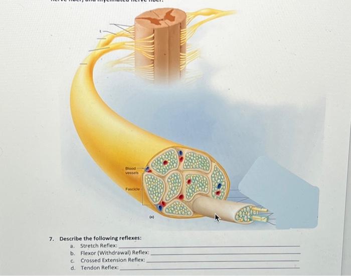 Solved b. Flexor (Withdrawal) Reflex c. Crossed Extension