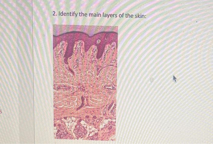 Solved 5. Identify the five layers of epidermis in this | Chegg.com
