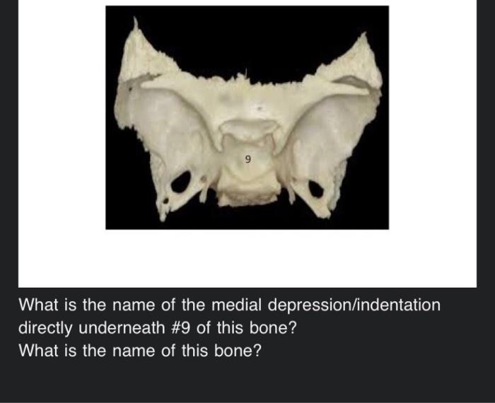 depression in a bone