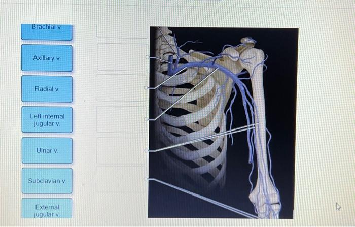 Solved Label the veins of the upper limb. | Chegg.com