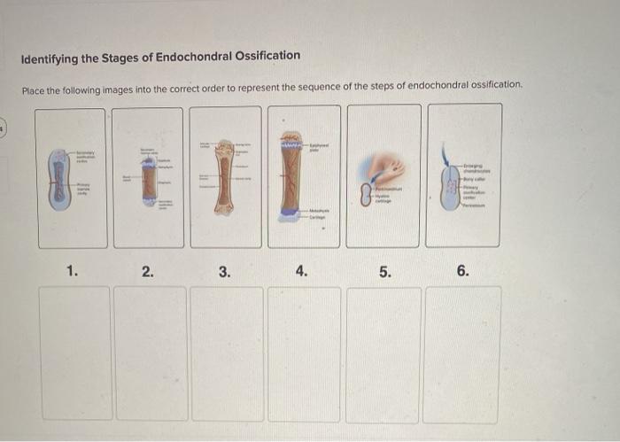 Solved Identifying the Stages of Endochondral Ossification | Chegg.com