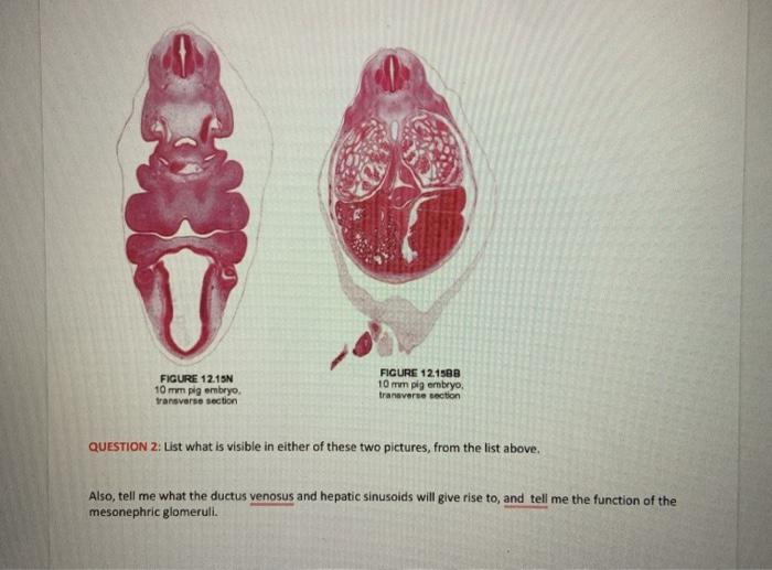 Solved FIGURE 12.15 10 mm pig embryo transverse section | Chegg.com