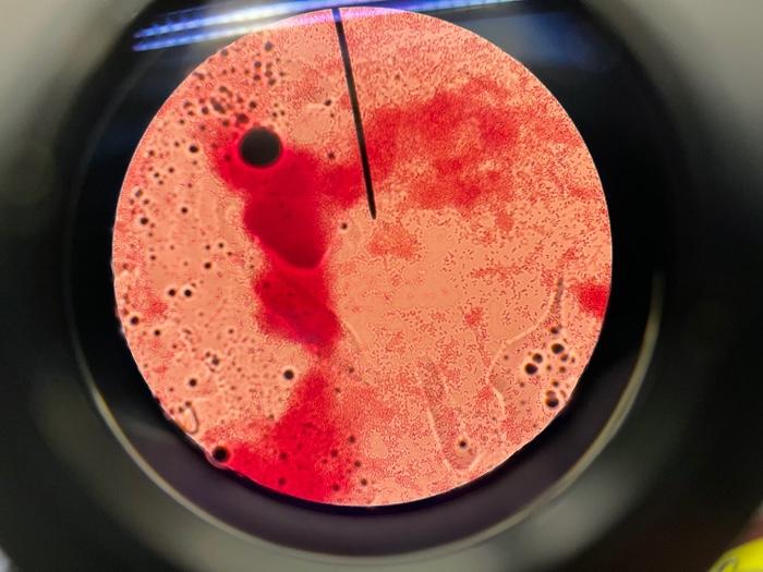 Solved microbiology !! (i attached my gram stain and my | Chegg.com