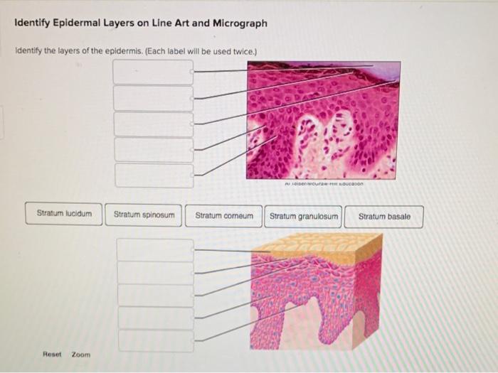 Solved Identify Epidermal Layers on Line Art and Micrograph | Chegg.com