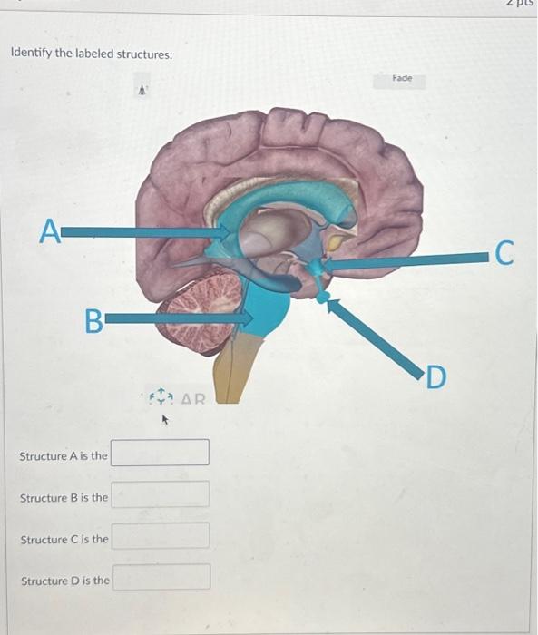 Solved Identify the labeled structures: A B Structure A is | Chegg.com