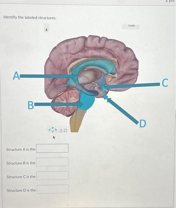 Solved Identify The Labeled Structures: A B Structure A Is | Chegg.com