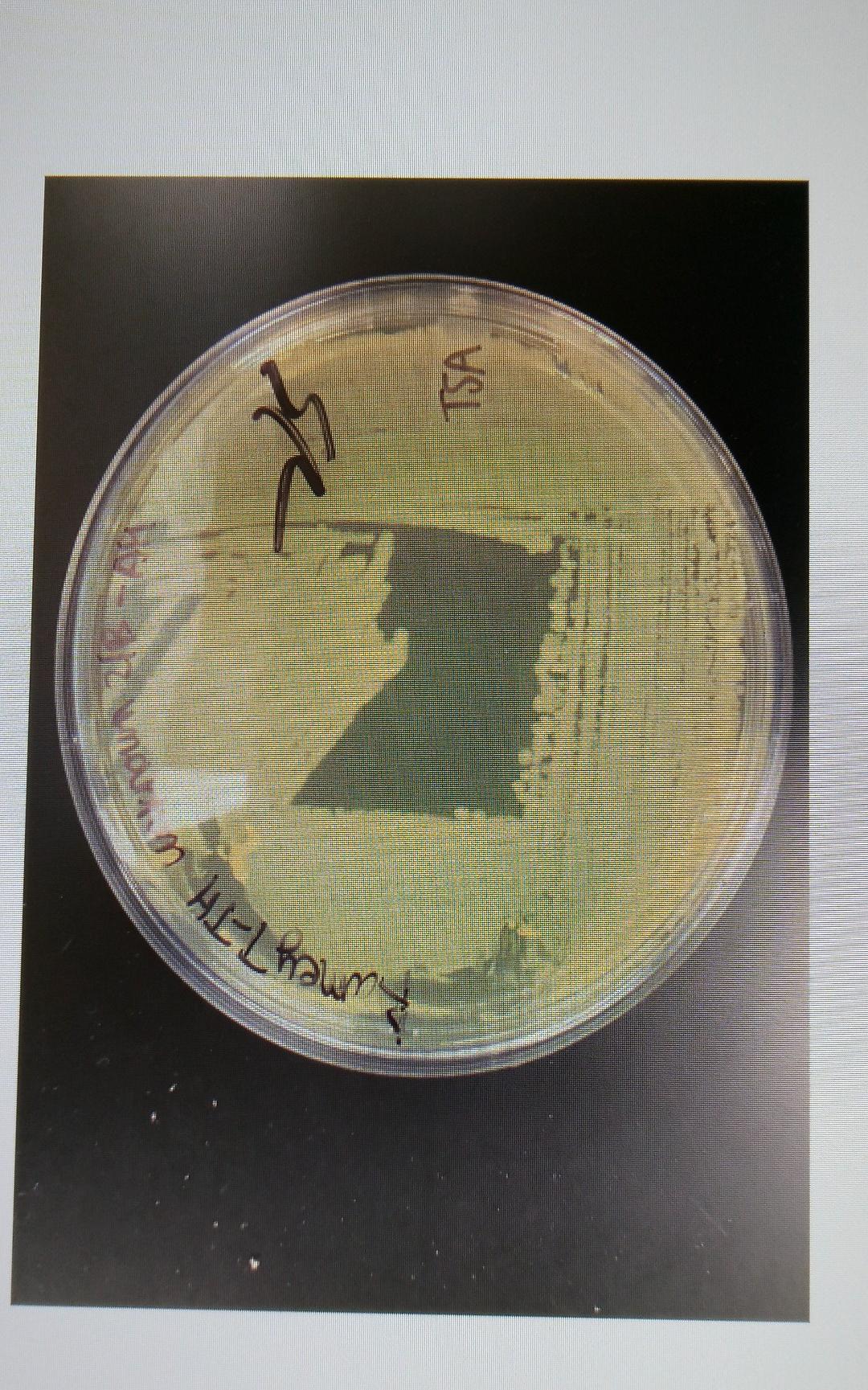 Solved Broth Characteristics Colony Characteristics