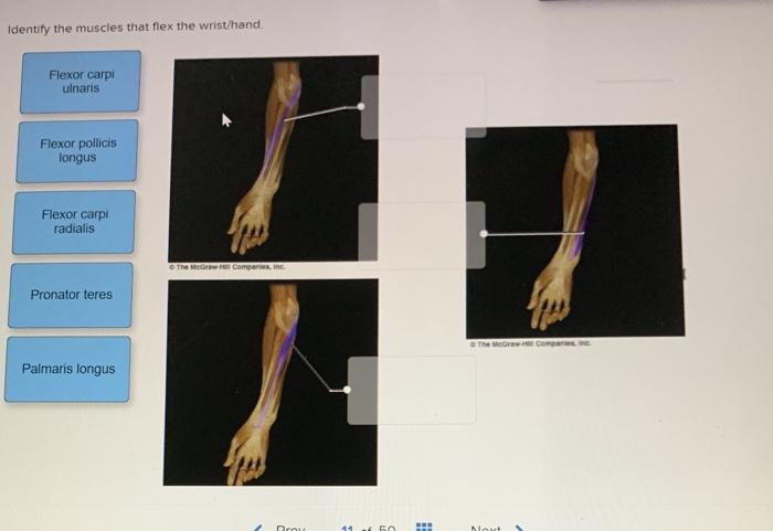 Wrist Hand Anatomy The Easy Way To Identify Flexor Muscles - w10guam