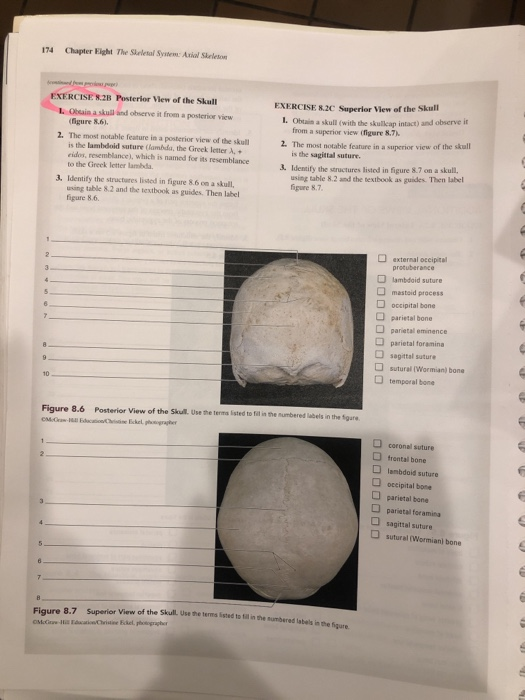 Solved 174 Chapter Eight The Skeletal System Axial Seson | Chegg.com