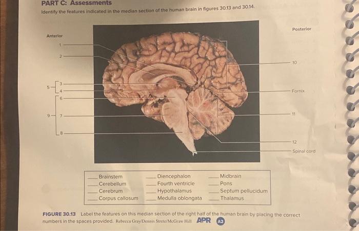 Study identifies characteristics specific to human brains