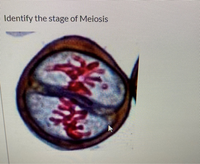 Solved Identify the stage of Meiosis | Chegg.com