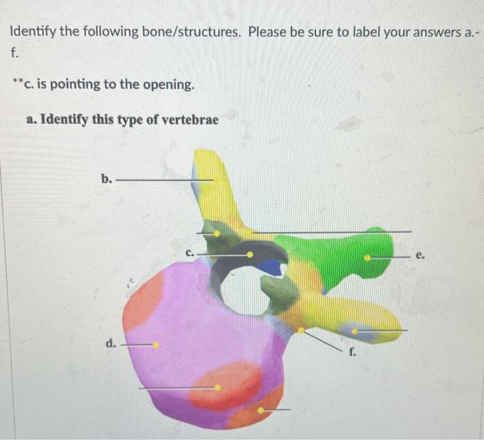 Solved Identify the following bone/structures. Please be | Chegg.com