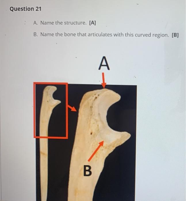 Solved Question 21 : A. Name The Structure. [A] B. Name The | Chegg.com