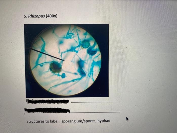 5. Rhizopus \( (400 x) \)
structures to label: sporangium/spores, hyphae