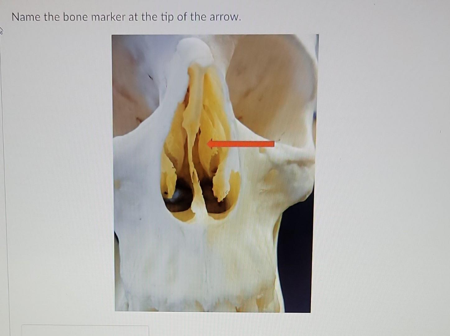 Tip Bone Solved Name the bone marker at the tip of the arrow. Name | Chegg.com
