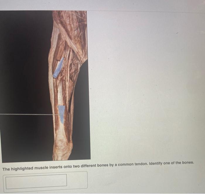 Solved The highlighted muscle acts on which structure of the | Chegg.com