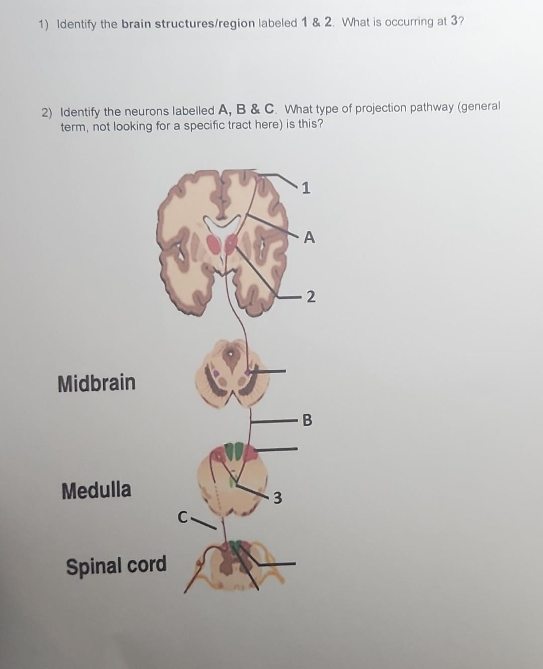 Solved 1) Identify the brain structures/region labeled 1&2. | Chegg.com