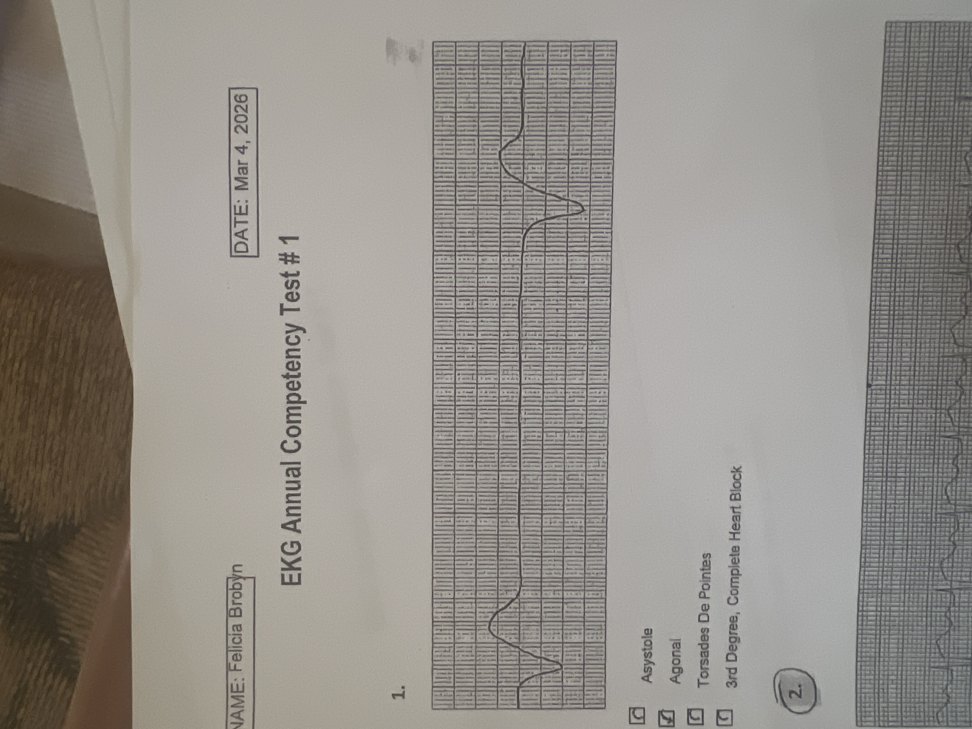 Ecg Competency EKG Annual Competency Test \# 1 1. Asystole Agonal | Chegg.com