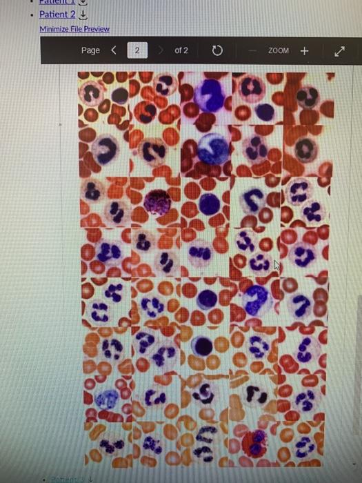 Solved Page 1 of 5 0 ZOOM + Case Study (Blood) Blood is | Chegg.com
