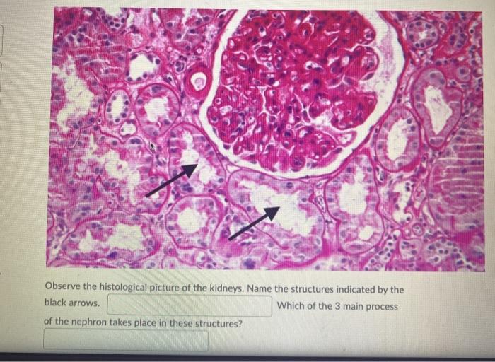 Solved Observe the histological picture of the kidneys. Name | Chegg.com