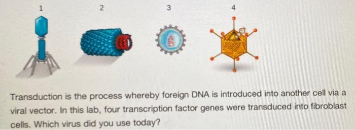 Solved 1 2 3 cam Transduction is the process whereby foreign | Chegg.com