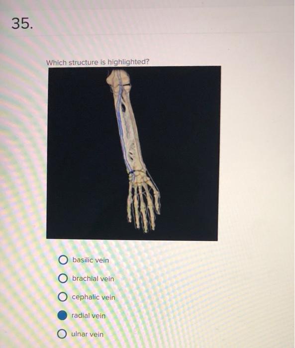 Solved 35. Which structure is highlighted? basilic vein