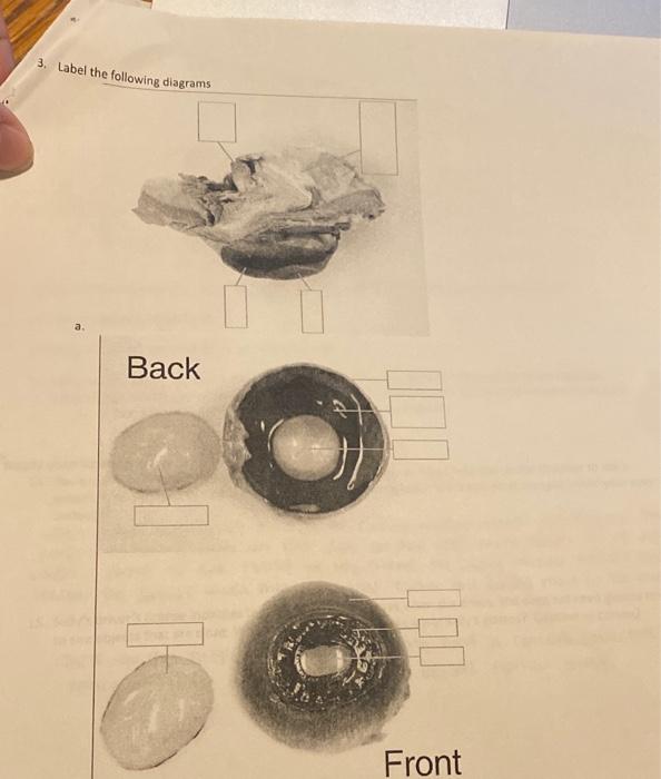 Solved 3. Label the following diagrams Back Front | Chegg.com