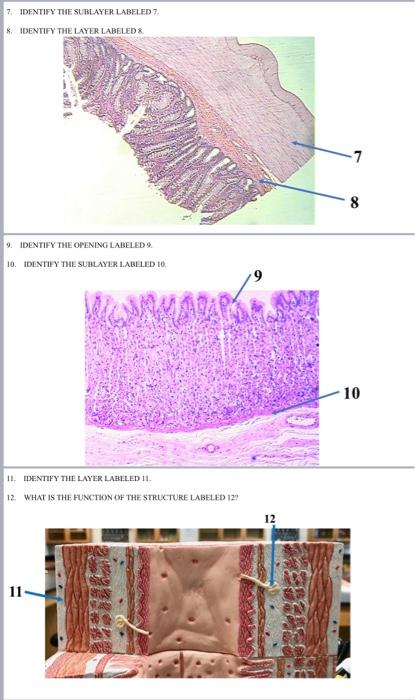 Solved 3. IDENTIFY THE TISSUE LABELED 3. 4. IDENTIFY THE | Chegg.com