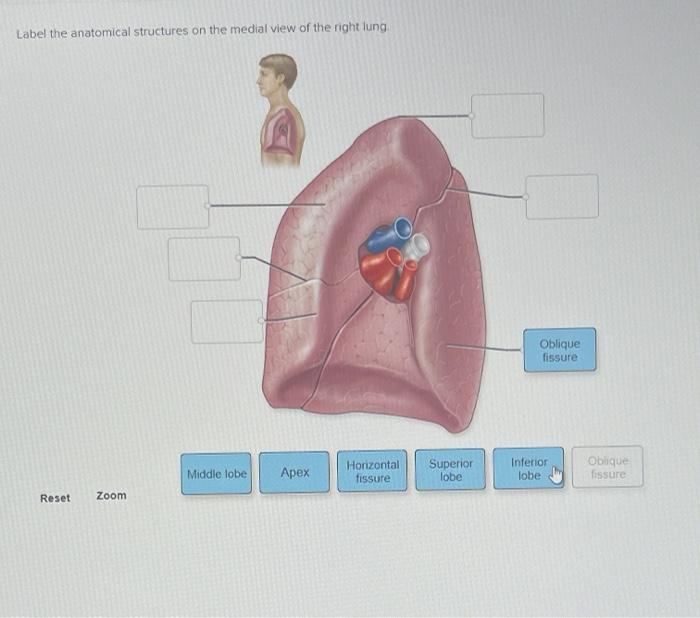 Solved Label the anatomical structures on the medial view of | Chegg.com