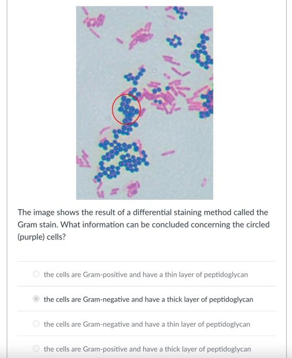 The image shows the result of a differential staining method called the Gram stain. What information can be concluded concern